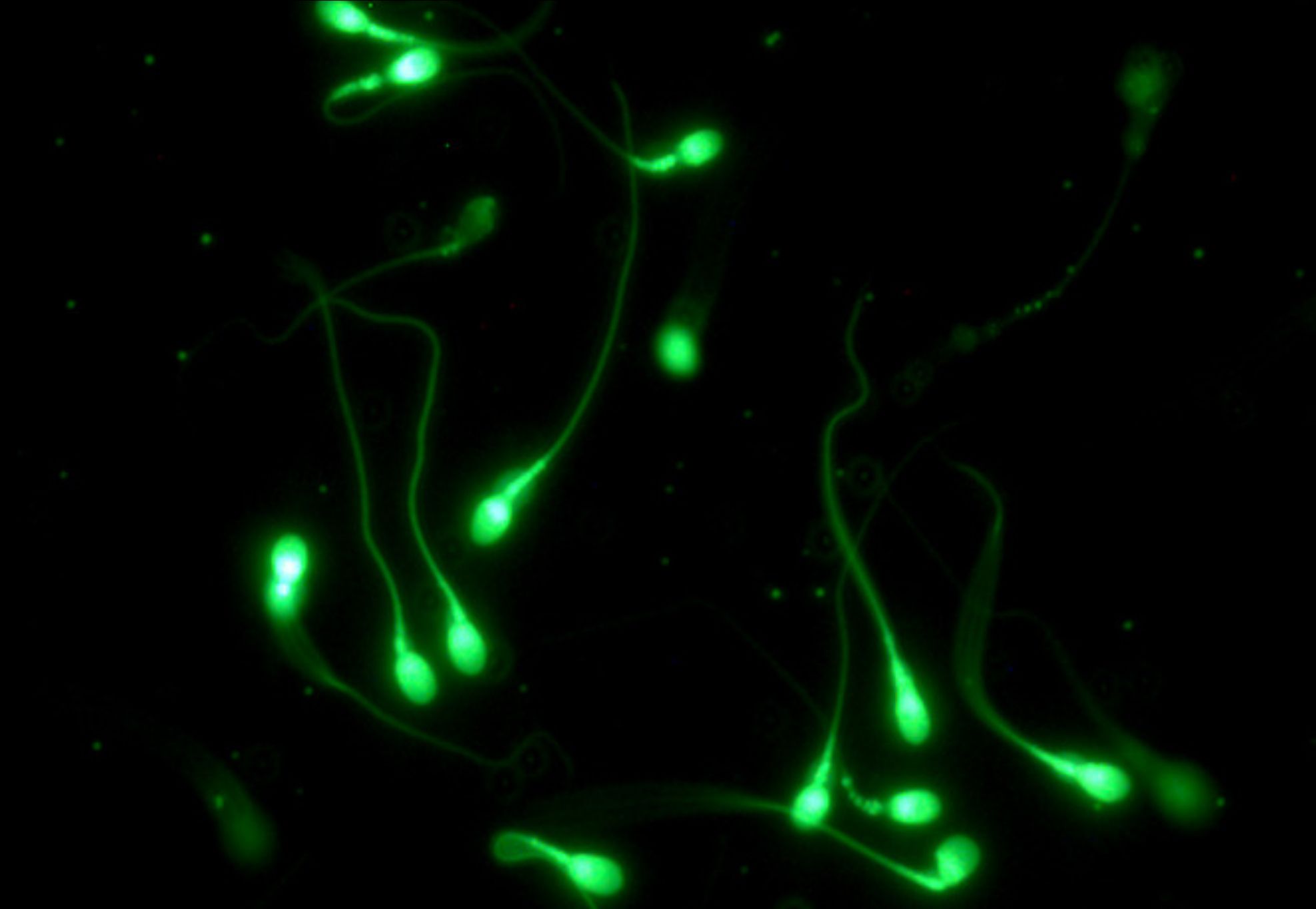 Human sperm cells against dark backdrop.