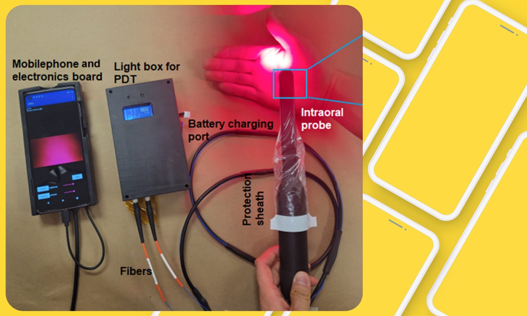 Device for oral scanning.