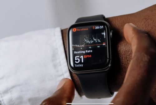 Apple Watch on a wrist