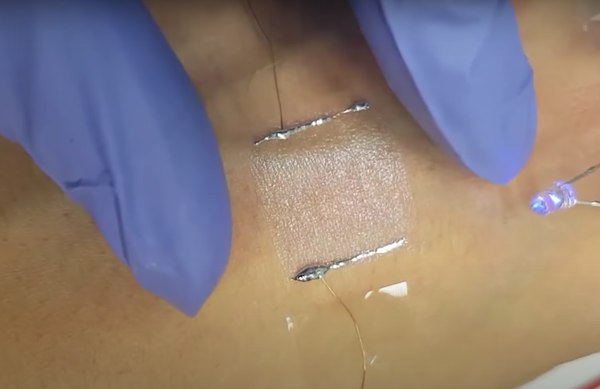 An transparent skin patch 